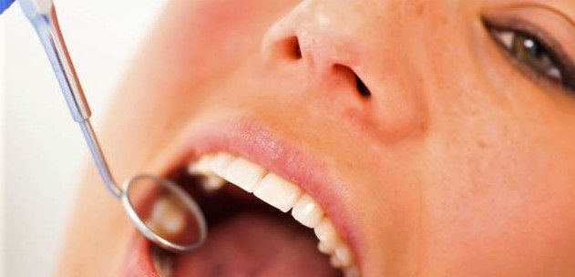 L’implant dentaire : quel est le coût de cette solution révolutionnaire ?