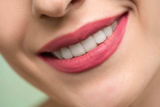 Meilleurs conseils pour un sourire parfait Meilleurs conseils pour un sourire parfait