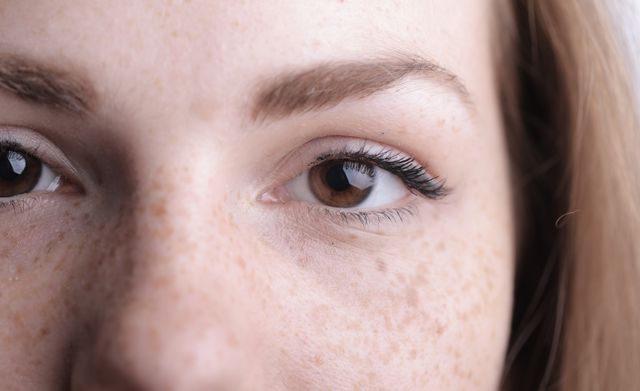 Sérum anti taches brunes : comment trouver le soin qui correspond vraiment à votre peau ?